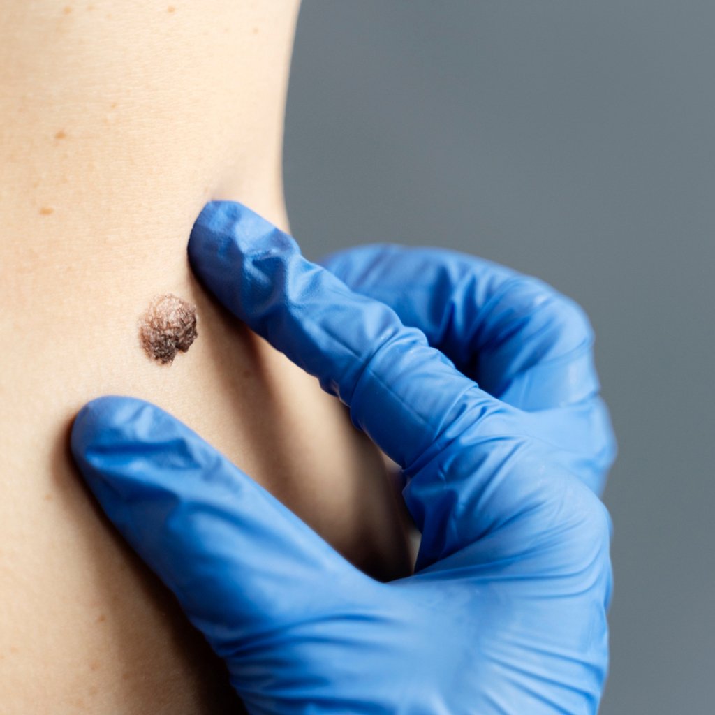 Minor Surgical Procedures 1 44