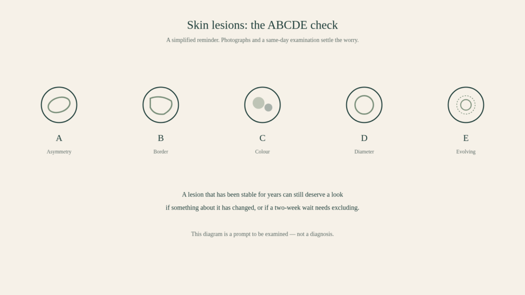 diagram abcde moles