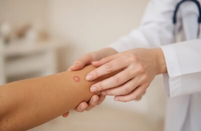 TB Test London: Same-Day Private Tuberculosis Screening at Clinique Alpa